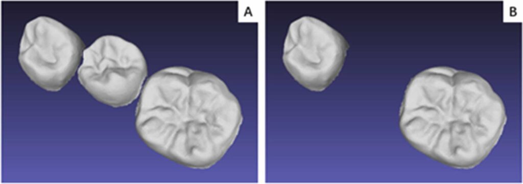 3d teeth