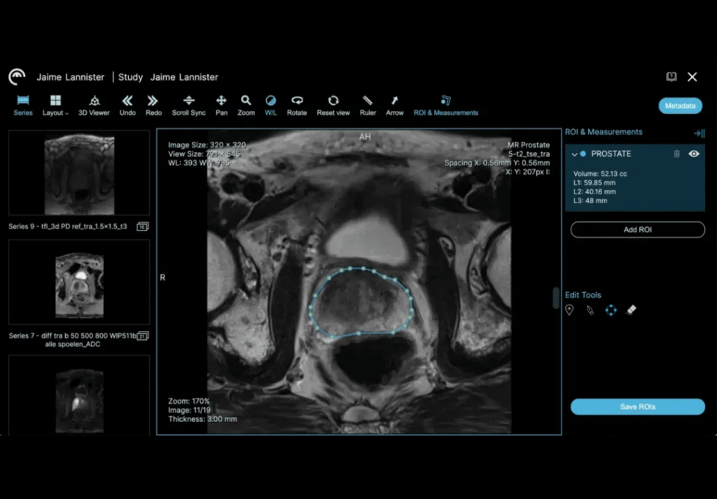 Ezra Flash AI-ondersteunde MRI-scan