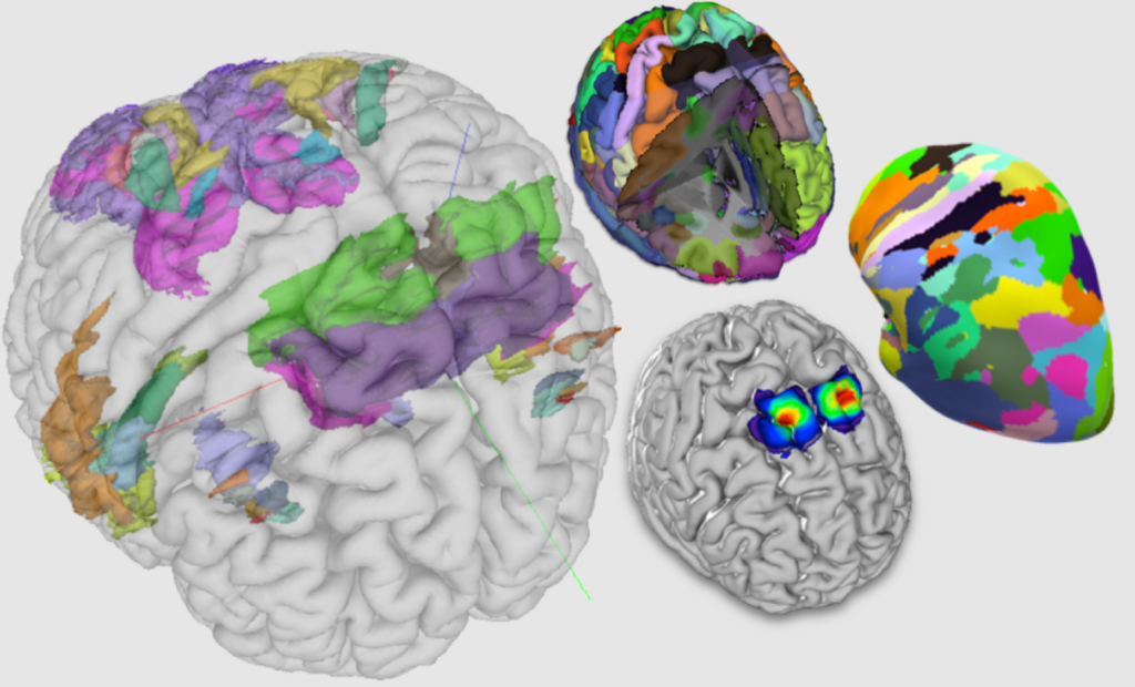 Gehirn-Atlas