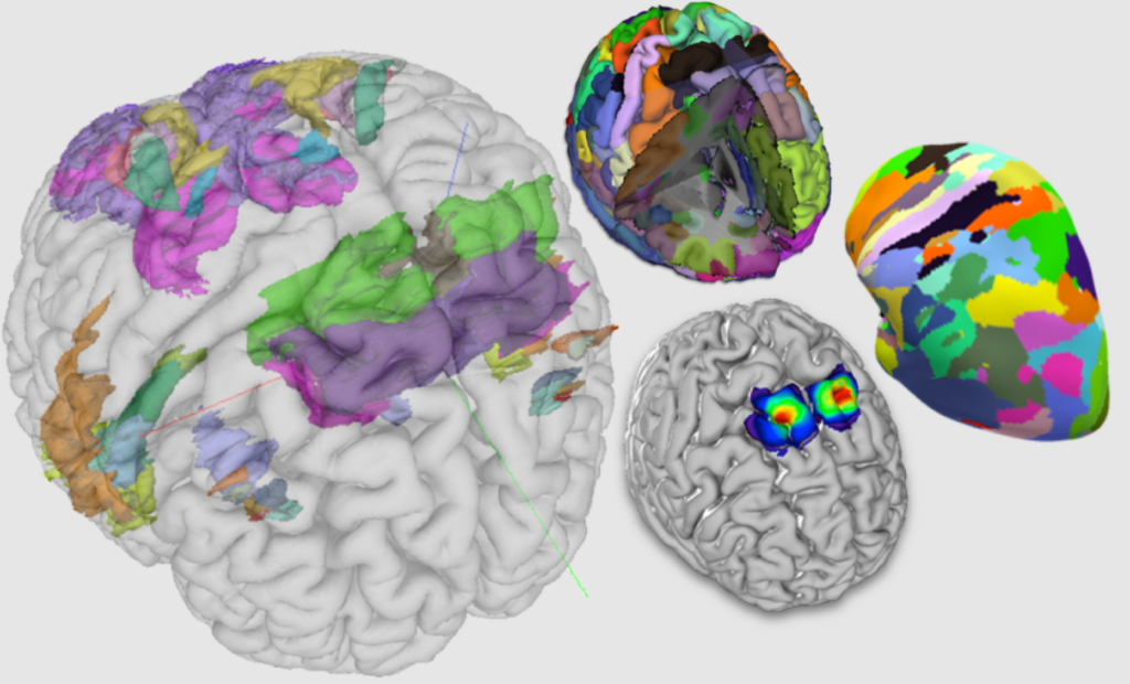 Brain Atlas